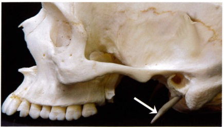 外側面の一部を除去した顎骨の写真を別に示す。矢印で示すのはどれか。
