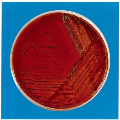 		血液寒天培地上に発育した細菌の集落像の写真を別に示す。考えられるのはどれか。		